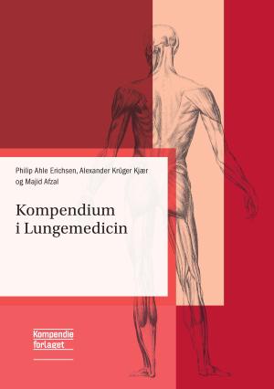 Bogcover til Kompendium i Lungemedicin